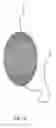 Fig. 06 - Radially extended support member for spinal nucleus implants and methods of use