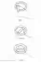 Fig. 08 - Radially extended support member for spinal nucleus implants and methods of use