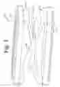 Fig. 02 - Devices and methods for inter-vertebral orthopedic device placement