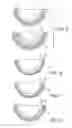 Fig. 04 - Prosthetic acetabular cup and method of manufacture