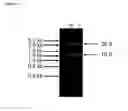 Fig. 14 - TAT-028 and methods of assessing and treating cancer
