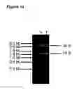 Fig. 18 - TAT-038 and methods of assessing and treating cancer
