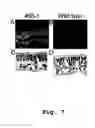 Fig. 08 - Edible vaccines expressed in soybeans