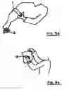 Fig. 05 - Sanitary collection and disposal device