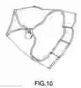 Fig. 11 - Workout glove