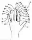 Fig. 01 - Surgical glove system