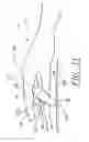 Fig. 09 - Surgical glove system