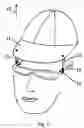 Fig. 02 - Spectacle support system