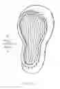 Fig. 13 - Disposable urine collection device