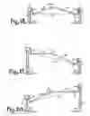 Fig. 14 - Patient positioning support structure