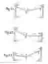 Fig. 15 - Patient positioning support structure