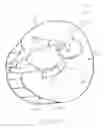 Fig. 33 - Support pillow and cover with mat and methods for using