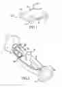 Fig. 02 - Swimming pool cleaner