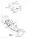 Fig. 02 - Swimming pool cleaner