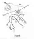 Fig. 14 - Hygienic, turning control element which is used to actuate a mechanism, such as a door opener