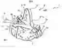 Fig. 01 - Device for retaining a boot on a snowshoe