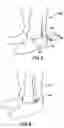 Fig. 06 - Device for attachment to a garment