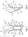 Fig. 02 - Lawn edging