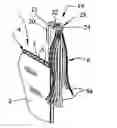 Fig. 01 - Clips for mounting decorations on corrugated core twinwall panels