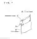 Fig. 08 - Vehicle interior trim component and method for manufacturing the same