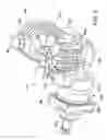 Fig. 07 - Hydrostatic transmission with external manifold