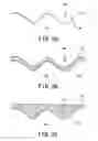 Fig. 03 - Glass molding die