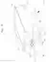 Fig. 11 - Method of reducing a stent in cross-section