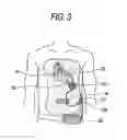 Fig. 05 - Mass flow meter