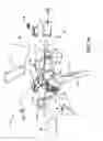 Fig. 11 - Bicycle control device