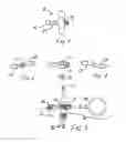 Fig. 04 - Drum tuning key