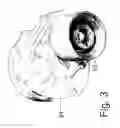 Fig. 03 - Supercharger drive pulley