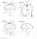Fig. 03 - Multi-purpose face and body condom