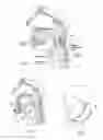 Fig. 02 - Devices, systems, and methods for stabilization or fixation of magnetic force devices used in or on a body