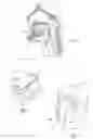 Fig. 03 - Devices, systems, and methods for stabilization or fixation of magnetic force devices used in or on a body