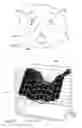 Fig. 04 - Devices, systems, and methods for stabilization or fixation of magnetic force devices used in or on a body