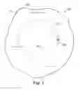 Fig. 04 - Patient warming drape