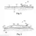 Fig. 05 - Patient warming drape