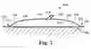 Fig. 06 - Patient warming drape