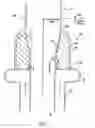 Fig. 02 - Outlet fitting for double pipe quench exchanger