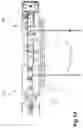 Fig. 17 - Mobile snubbing system