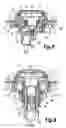 Fig. 05 - Lighted module applicable to a pushbutton-type switch assembly, and a pushbutton-type switch assembly with a lighted module