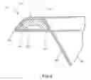 Fig. 09 - Container having a rim or other feature encapsulated by or formed from injection-molded material