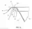 Fig. 13 - Container having a rim or other feature encapsulated by or formed from injection-molded material