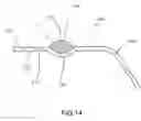Fig. 14 - Container having a rim or other feature encapsulated by or formed from injection-molded material