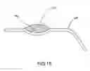 Fig. 15 - Container having a rim or other feature encapsulated by or formed from injection-molded material