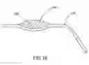 Fig. 16 - Container having a rim or other feature encapsulated by or formed from injection-molded material