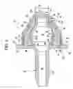 Fig. 04 - One-way valve and apparatus and method of using the valve
