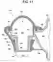 Fig. 10 - One-way valve and apparatus and method of using the valve