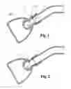 Fig. 02 - Anti-clogging showerhead device