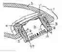Fig. 01 - Aerator of a plumbing fixture